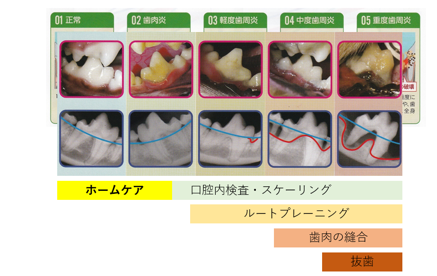 歯周病③～歯みがき・ホームケア～01